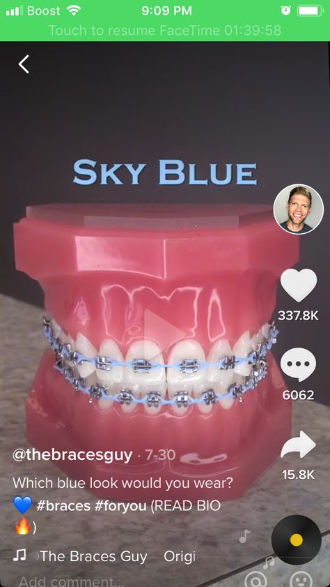 Baby Blue Braces, Power Chain Braces, Braces Transformation, Dental Braces Colors, Braces Colors Combinations, Blue Braces, Tongue Web Piercing, Braces And Glasses