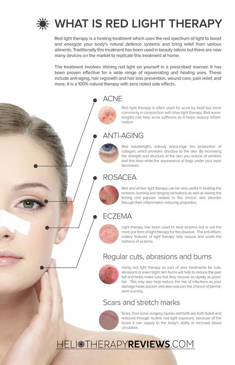 Our handy inforgraphic shows all the uses of red light therapy.  Visit: http://www.heliotherapyreviews.com/red-light-therapy Skin Layers, Make Up Inspiration, Beauty Therapy, Led Light Therapy, Skin Therapy, Secret Beach, Red Light Therapy, Med Spa, Red Led