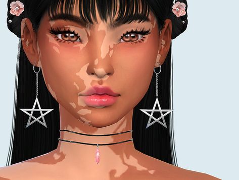 Saruin's Skin Detail| Vitiligo Set No. 2 The Sims 4 Cc Face Details, Sim4 Cc Skin Details, The Sims 4 Cc Viltigo, Tsr Skin Details, Ts4cc Skin Details, Sims 4 Cc Vitigilo, Sims 4 Cute Skin Overlays, Vilitigo Skin Sims 4 Cc, Sims4cc Face