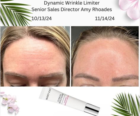 I mean… why would you NOT try this?! Mary Kay Clinical Solutions, Marykay Skincare, Skincare Wrinkles, Wrinkle Filler, Get Rid Of Wrinkles, Mary Kay Consultant, Deep Wrinkles, Skin Issues, Pain Free