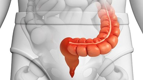 How Diverticulitis Affects the Sigmoid Colon Postnatal Massage, Sigmoid Colon, Regular Bowel Movements, Bowel Movement, Natural Colon Cleanse, Prenatal Care, Irritable Bowel, Respiratory Health, Deep Tissue Massage