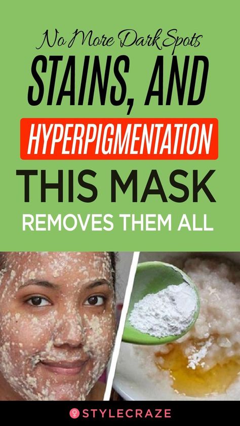 Beauty Tips For Face, Clean Face, Mouthwash, Face Scrub, Teeth Whitening, Blackheads, Dark Spots, Glowing Skin, Natural Remedies