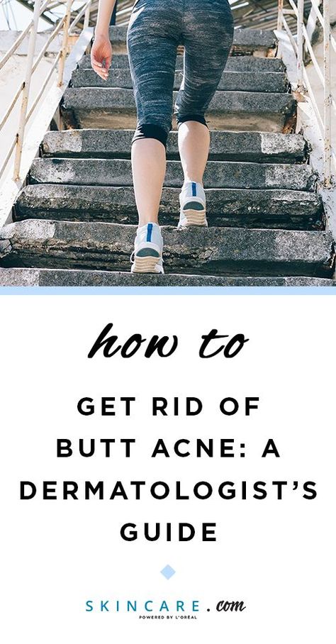 Got pimples on your buttocks? We're sharing an expert guide to folliculitis, or butt acne, including what causes the pesky bumps on your bum and how to get rid of them! #skin #skincare #skincareroutine #bodyacne #chestacne #backacne #shoulderacne #beauty #beautyroutine #beautyhacks #beautytips #beautyadvice #dermatologist #esthetician #springbeauty #skincarehelp #skincaretips #skincareadvice #skincarehacks #skincareroutineacne How To Avoid Pimples, Buttocks Acne, What Causes Pimples, Shoulder Acne, Pimples On Buttocks, Chest Acne, Pimples Under The Skin, Be Uncomfortable, Bad Acne