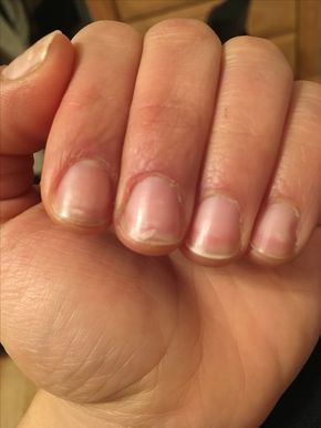 Nail Strengthener Diy, Best Cuticle Oil, Nail Polish Tips, Grow Long Nails, Nail Remedies, Split Nails, Health Nails, Peeling Nails, Ombre Nail Art