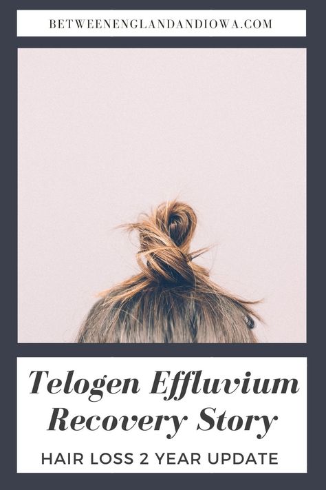 Top of head with a messy bun, woman with brown hair. Telogen Effluvium Recovery Story title. Telogen Effluvium Hairstyles, Telogen Effluvium Recovery, Female Balding, Telogen Effluvium, Hair Recovery, Hair Shedding Remedies, Homemade Facial Mask, Hair Gloss, Home Remedies For Hair