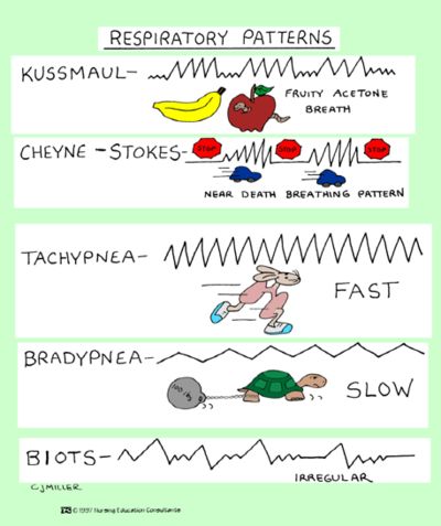 Respiratory Patterns Respiratory Nursing, Medical Diagrams, Emt Study, Paramedic School, Nursing Information, Nursing Mnemonics, Surgical Nursing, Respiratory Care, Nursing School Survival