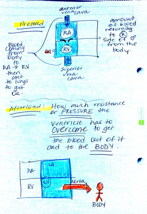 preload vs afterload Preload Vs Afterload, Preload And Afterload Nursing, Nursing Graphics, Nursing Cardiac, Pharmacology Notes, Pacu Nursing, Np School, Pharm Tech, Nurse Teaching