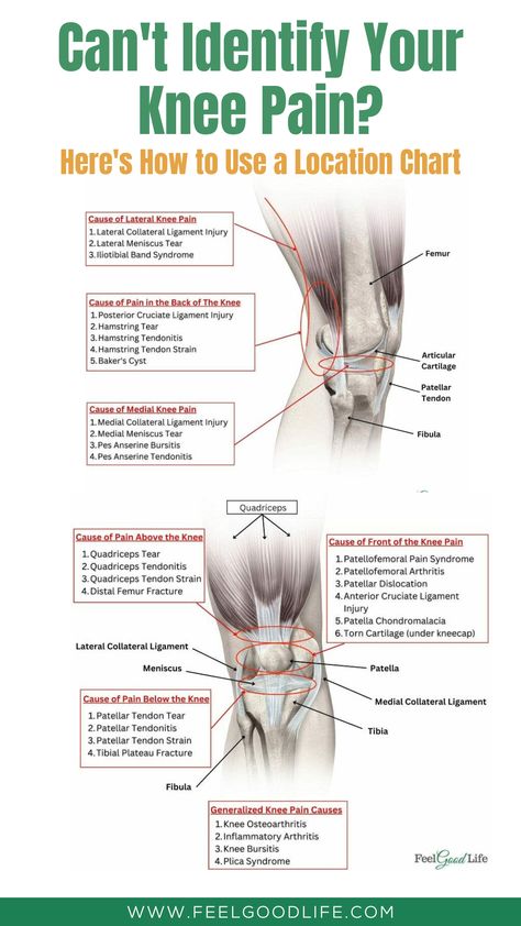 Struggling to identify your knee pain? Learn how to utilize a knee pain location chart to narrow down potential causes. With this guide, you can understand the intricate anatomy of the knee and how different types of pain correlate with specific conditions. Perfect for beginners and those seeking better knowledge about their body. #kneepain #painmanagement #healthtips #exercises #painlocationchart Medial Knee Pain, Anatomy Of The Knee, Knee Pain Relief Remedies, Patellofemoral Pain Syndrome, Knee Problem, Pain Relief Remedies, Ligament Injury, Knee Pain Relief, Medical Anatomy