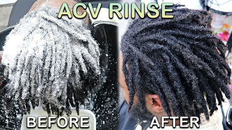 My First ACV RINSE on DREADLOCKS | How To WASH LOCS (Starter Locs Journey) Starter Locs Journey, Locs Starter, Acv Rinse, Locs Journey, Starter Locs, Loc Journey, Locs, Dreadlocks, Quick Saves