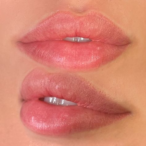 Medium Size Lips, Natural Lip Blushing, Keyhole Pout Lips, Lip Filler Natural Look, Natural Lips Aesthetic, Lip Filler Inspiration 1ml, Natural Lip Look, Pout Lip Filler, Perfect Lips Aesthetic