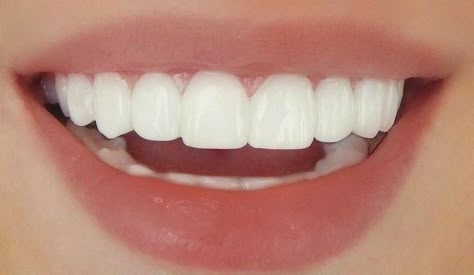 Teeth Aesthetic, Pretty Teeth, Studera Motivation, Beautiful Teeth, Straight Teeth, Porcelain Veneers, Perfect Teeth, Smile Teeth, Dream Vision Board