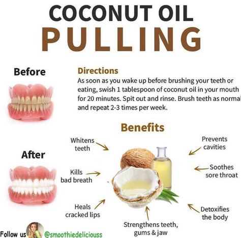 Oil Pulling Recipe, Benefits Of Coconut, Strengthen Teeth, Teeth Whitening Remedies, Resep Diet, Coconut Oil Pulling, Teeth Health, Natural Healing Remedies, Benefits Of Coconut Oil