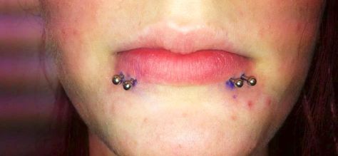 Shark Bites #shark #bites #labret #lip #piercing #oral #facial #oralpiercing #facialpiercing Sharkbite Piercing, Shark Bites Piercing, Labret Lip Piercing, Shark Bites, Lip Piercing, Piercings, Facial, Nose Ring, Portfolio