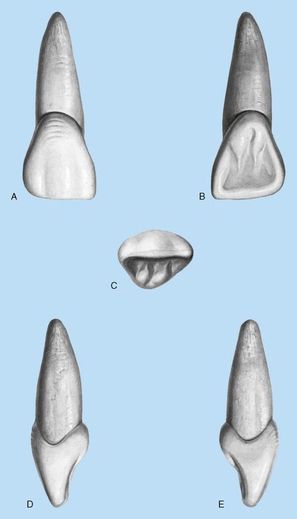 Dental Anatomy Drawing, Maxillary Central Incisor, Dental Morphology, Tooth Morphology, Teeth Anatomy, Teeth Drawing, Chemistry Basics, Kedokteran Gigi, Dental Hygiene School