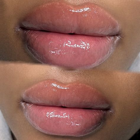 Natural Lip Plumper, Lips Inspiration, Botox Lips, Feminine Tattoo Sleeves, High Cheekbones, Lip Shapes, Lip Injections, Smooth Lips, Glamour Makeup