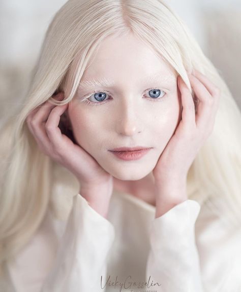 Platinum Blonde Hair And Blue Eyes, Albino Girl Aesthetic, Albino Woman, Albino People, Albino Model, Albino Girl, Beauty Care Routine, Fantasy Gowns, Platinum Blonde Hair