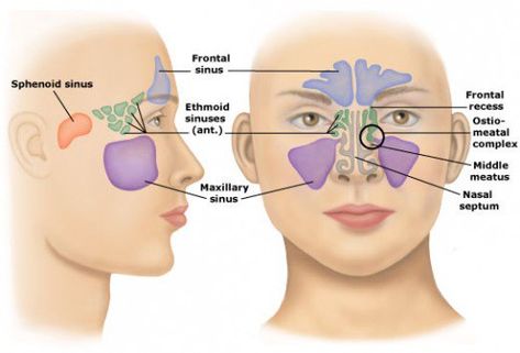 Shortness Of Breath Remedies, Sinusitis Symptoms, Paranasal Sinuses, Allergic Rhinitis, Using Essential Oils, Patient Education, Sinus Infection, Natural Pain Relief, Coconut Oil Hair