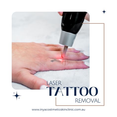 Laser Technician, Microblading Studio, Age Tattoo, Studio Tattoo, Laser Tattoo, Laser Tattoo Removal, House Of Beauty, Skin Clinic, Tattoo Removal