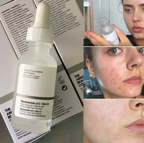 Glowing Skin By Catherine Ordinary Niacinamide, Vitamin And Mineral, Skin Care Basics, Congested Skin, Facial Skin Care Routine, Face Acne, Moisturizing Serum, Face Hydration, Skin Care Serum