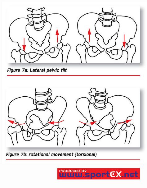 Back View Anatomy, Lateral Pelvic Tilt, Posterior Pelvic Tilt, Pelvis Anatomy, Fix Your Posture, Pelvic Health, Dynamic Stretching, Pelvic Tilt, Dance Images