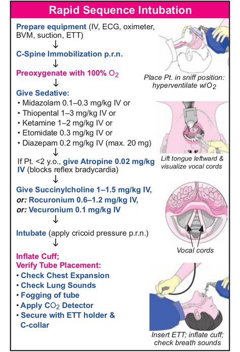 Rapid Sequence Intubation Nurse Anesthesia, Drawing Marvel, Flight Nurse, Nurse Anesthetist, Nursing Mnemonics, Pharmacology Nursing, Nursing School Survival, Critical Care Nursing, Respiratory Therapy