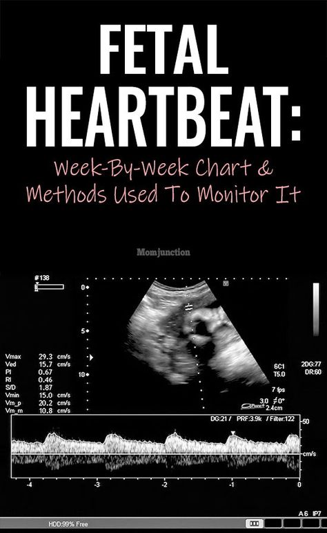 Fetal Heartbeat: Week-By-Week Chart And Methods Used To Monitor It : which lets you hear the fetal heartbeat and tells you if your pregnancy is progressing healthily. Find out more about what the baby’s heartbeat indicates, and how you can monitor it regularly in this MomJunction article about fetal heartbeat during pregnancy. #pregnancy #healthypregnancy #fetalheartbeat #pregnancycare Fetal Heart Rate Chart, 7 Weeks Pregnant Ultrasound, Fetal Heart Monitoring, Pregnancy Care Package, 7 Weeks Pregnant, Pregnancy Quotes Funny, Baby Heart Rate, Fetal Heart Rate, 24 Weeks Pregnant