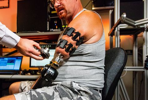 The Myo armband is being used to control a prosthetic arm by researchers at Johns Hopkins I Engadget Prosthetic Limbs, Prosthetic Arm, Robot Mechanics, Muscular System, Therapy Resources, Assistive Technology, Johns Hopkins University, Johns Hopkins, Fitbit Charge