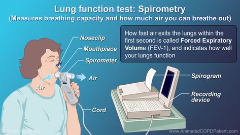 To make sure that your breathing problems are because of COPD, your clinician must order the lung function test, called spirometry. During spirometry, you will be asked to take a deep breath and then exhale as hard and as fast as you can into a tube that is connected to a machine, called a spirometer.  This test measures how much air you can breathe out, and how fast you blow air out. This test is simple, quick, painless, and accurate. Spirometry can predict COPD before symptoms are noticed or r Pulmonary Function Test, Pulse Oximetry, Arterial Blood Gas, Lung Conditions, Asthma Inhaler, Pulmonology, Chronic Obstructive Pulmonary Disease, Breathing Problems, Respiratory Illness