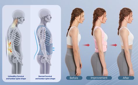 Amazon.com: Back Brace and Posture Corrector for Women and Men, Back Straightener Posture Corrector, Scoliosis and Hunchback Correction, Back Pain, Spine Corrector, Support, Adjustable Posture Trainer, Pink, Small (Waist 26-34 inch) : Industrial & Scientific Posture Correction Exercises Women, Back Corrector, Posture Correction Exercises, Shoulder Posture, Posture Corrector For Women, Men Back, Correct Posture, Back Brace, Human Nutrition