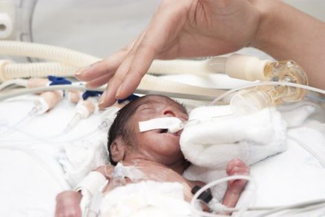 Premature birth can alter the connectivity between key areas of the brain, according to a new study. The findings should help researchers to better understand why premature birth is linked to a greater risk of neurodevelopmental problems, including autistic spectrum disorders and attention deficit disorders. Stronger connections involving face and lips in babies born preterm may reflect their early exposure to breastfeeding and bottlefeeding, while the reduced connectivity in other brain regi... Women Heart Health, Infant Massage, Pediatric Pt, Pediatric Physical Therapy, Career Ideas, Premature Birth, Brain Connections, Pediatric Therapy, Preemies