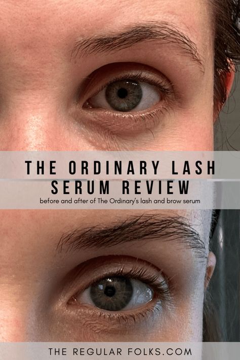 eyelash serum, beauty tips, beauty routine tips, lash growth Eyelash Serum The Ordinary, The Ordinary Lash Serum Before And After, The Ordinary Eyelash Serum, Ordinary Lash Serum Results, Ordinary Eyelash Serum, The Ordinary Lash Serum, Fuller Eyebrows, Human Body Temperature, Lashes Extensions