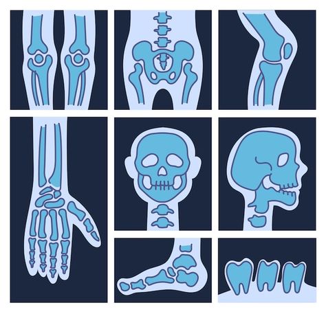 X Ray Effect Drawing, X Ray Painting, Xray Drawing, X Ray Drawing, X Ray Art, X Ray Skeleton, Skull Xray, Radiology Art, Cartoon Drawing Reference