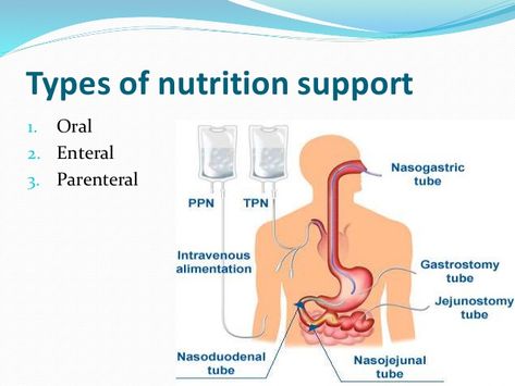 Refeeding Syndrome, Enteral Feeding, Fluid And Electrolytes, Word Board, Medical Devices, Head And Neck, Health Education, Nursing School, The Top