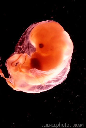 Baby In Womb, Human Embryo, Fetal Development, Weeks Pregnant, Pregnancy Symptoms, Medical Illustration, Medical Science, Anatomy And Physiology, The Human Body