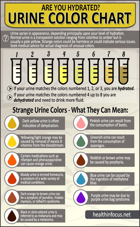 Health In Focus Are You Hydrated? Strange Urine Colors And Their Meaning - Health In Focus Urine Color Chart, Urine Color, Clogged Arteries, Medical Laboratory Science, Nursing School Survival, Nursing School Studying, Medical Facts, Health Professional, Nursing School Tips