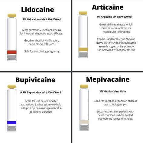 Local Infiltration Dental, Dental Hygiene School Notes, Dental Xrays Tips, Local Anesthesia Dental Hygiene, Dental Hygiene School Supplies, Local Anesthesia Dental, Dental Hygiene School Study Guides, Dental Assistant Study Notes, Dental Anesthesia