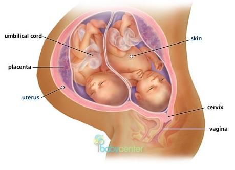 Fraternal twins in the womb: 36 weeks | BabyCenter 36 Weeks Pregnant Symptoms, Twins In The Womb, Pregnant Symptoms, Pregnant With Twins, 36 Weeks Pregnant, 36 Weeks, Twin Life, Fraternal Twins, Fetal Development