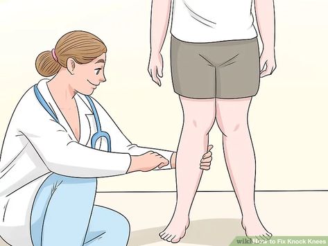 3 Ways to Fix Knock Knees - wikiHow Fix Knock Knees, Knock Knees Exercises, Genu Valgum, Knock Knees, Simple Lifestyle, Knee Exercises, Simpler Lifestyle, Anatomy And Physiology, Lifestyle Changes