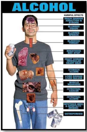 Should Christians Drink? Alcohol Withdrawal Symptoms, Alcohol Awareness, Alcohol Withdrawal, Forensic Anthropology, Relapse Prevention, Effects Of Alcohol, Gcse Science, Health Watch, Withdrawal Symptoms