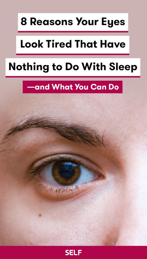 The truth is, a lot of people have dark circles or puffy eyes. And though there’s nothing wrong with that, many of us are looking for ways to minimize them. While they are often hallmarks of a lack of sleep, there are other causes that have nothing to do with how many zzz’s we catch (or don’t catch) each night. In fact, you might have another health concern or lifestyle habit causing your tired-looking eyes that you may want to address. How To Do Sleepy Eyes, How To Get Rid Of A Lazy Eye, Tired Looking Eyes, Tired Beauty Look, How To Do Tired Eyes Makeup, Tired Eyes Remedy, How To Fix Tired Looking Eyes, Tired Girl Eye Makeup, Headache Behind Eyes