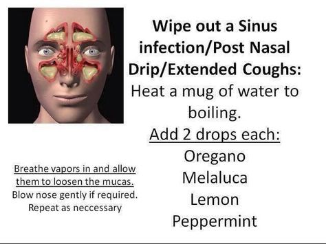 Sinus infection, post nasal drip, extended cough protocol Essential Oils For Sinus Infection, Oils For Sinus Infection, Essential Oils Sinus, Sinus Remedies, Oils For Sinus, Sinus Infection Remedies, Essential Oil Usage, Essential Oil Remedy, Oil Remedies