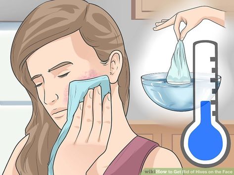 3 Ways to Get Rid of Hives on the Face - wikiHow How To Get Rid Of Rash On Face, Face Rash Remedies How To Get Rid, Allergic Reaction On Face Remedies, Itchy Face Remedy, Hives On Face, Face Rash Remedies, Allergy Hives, Face Rash, Types Of Skin Rashes