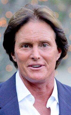 Bruce Jenner Before and after Photos Caitlyn Jenner Before And After, Plastic Surgery Gone Wrong, Bruce Jenner, Hairstyle Names, Celebrity Plastic Surgery, Caitlyn Jenner, Under The Knife, Cosmetic Procedures, Bruce Wayne