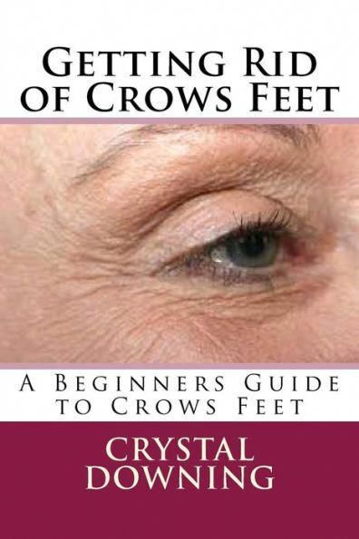 Getting Rid Of Crows Feet: A Beginners Guide To Crows Feet by Crystal Downing, 9781537518725, available at LibroWorld.com. Fast Delivery. 100% Safe Payment. Worldwide Delivery. Brown Spots On Hands, Brown Spots On Skin, Pimples Remedies, Skin Images, Brown Spots Removal, Brown Spots On Face, Skin Spots, Spots On Face, Dark Under Eye