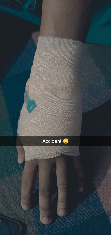 Hat Kata Pic Real, Broken Hands Fake Story, Bike Accident Hand Dpz, Accident Pic Of Bike, Hand Kata Pic Real, Hand Plaster Fracture, Fracture Hand Snapchat, Accident Hand Dpz, Hand Fracture Pics