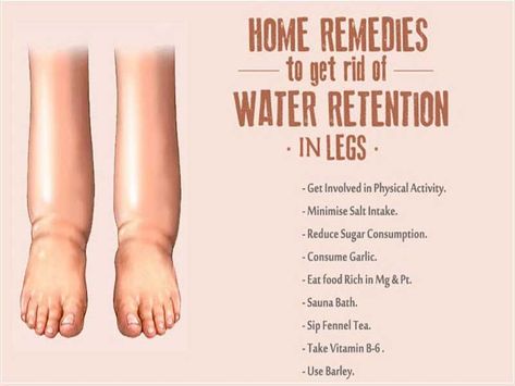 Water Retention Remedies, Inflammation Recipes, Reduce Thigh Fat, Colon Cleansing, Exercise To Reduce Thighs, Lose Thigh Fat, Lower Back Pain Exercises, Natural Colon Cleanse, Easy Detox