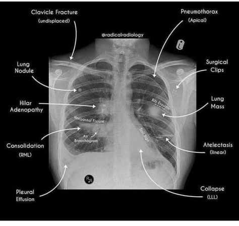 Medical Radiography, Emt Study, Radiology Student, Nurse Practitioner School, Radiology Imaging, Interventional Radiology, Vet Medicine, Medical Student Study, Pulmonology