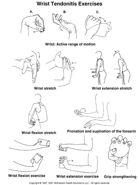 Wrist exercises Wrist Exercises Strength, Golfers Elbow Exercises, Tennis Elbow Exercises, Hand Therapy Exercises, Carpal Tunnel Exercises, Elbow Exercises, Sprained Wrist, Wrist Pain Relief, Golfers Elbow