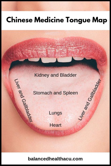 Areas of the tongue correspond to specific organ systems in the body according to Traditional Chinese medicine. Check out how to read your tongue and what it tells you about your health. Organ System, Health Tips For Women, The Tongue, Diy Health, Traditional Chinese Medicine, Health Info, Health Advice, Chinese Medicine, Natural Medicine