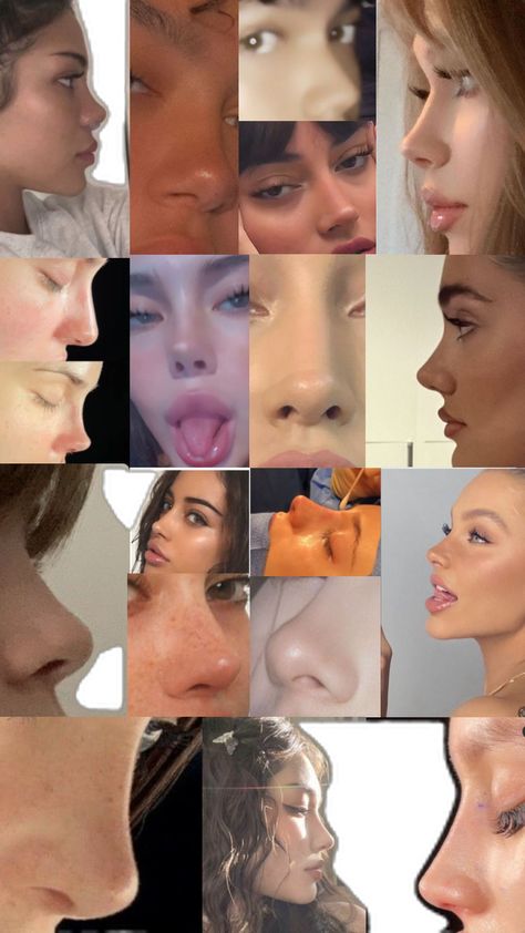 Upturned Nose, Nose Types, Rhinoplasty Nose Jobs, Straight Nose, Pretty Nose, Perfect Nose, Small Nose, Button Nose, Nose Shapes